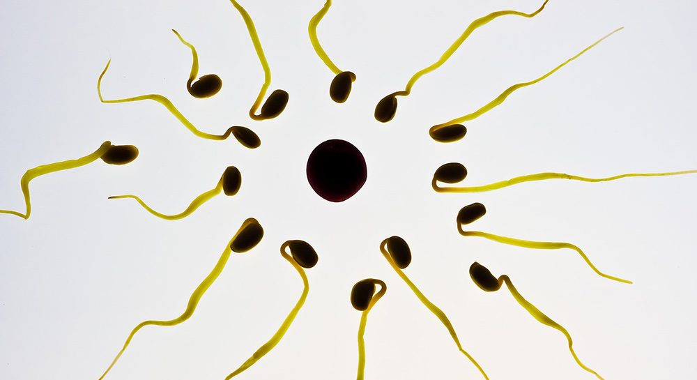 what happens to sperm after vasectomy