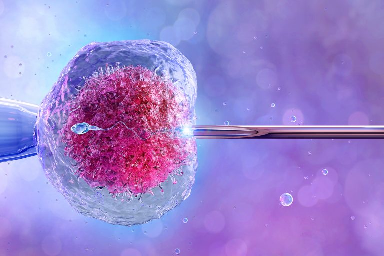 ivf after vasectomy
