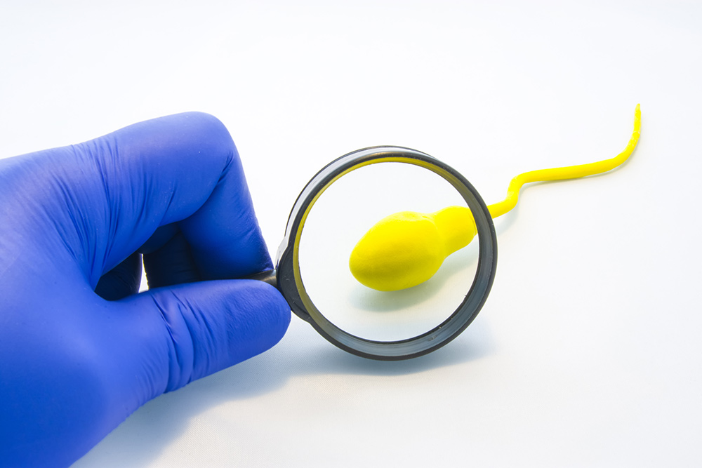 facts about vasectomy
